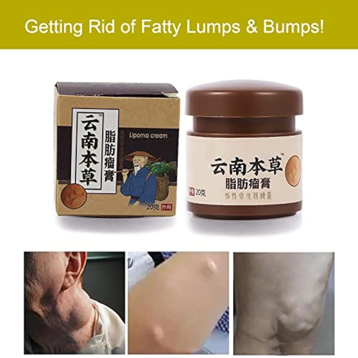 Lip removal cream cellulite removal ointment skin swelling lipolysis fat mass body hard block removal medicine 20g