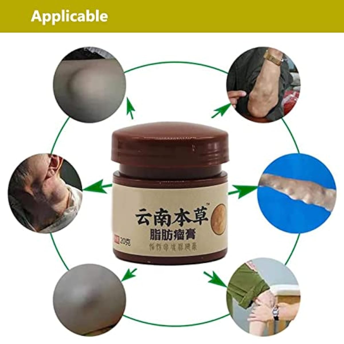 Lip removal cream cellulite removal ointment skin swelling lipolysis fat mass body hard block removal medicine 20g